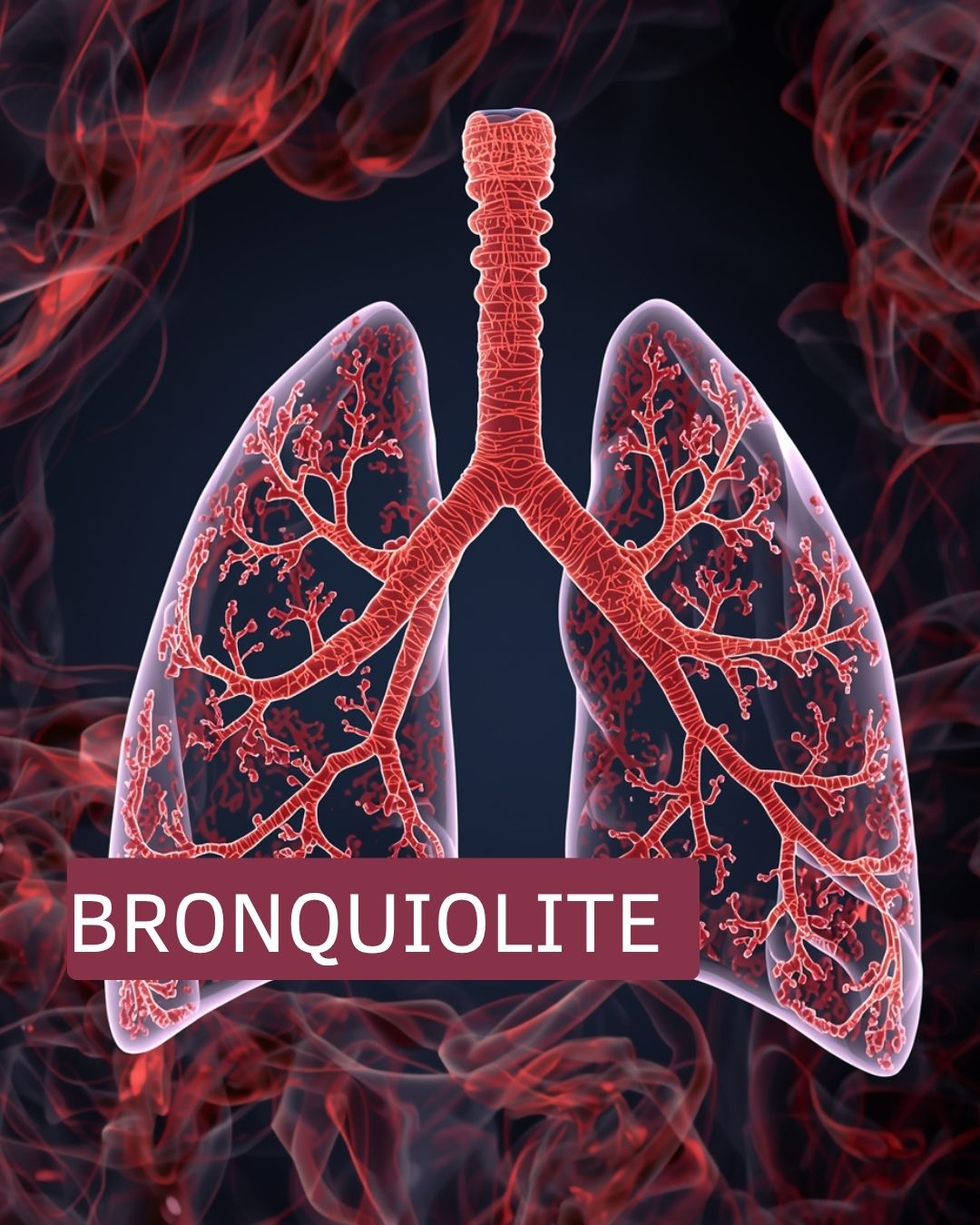 pneumologista infantil Curitiba